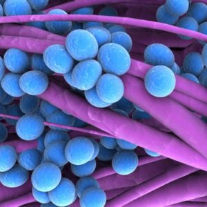 Staph Infection
