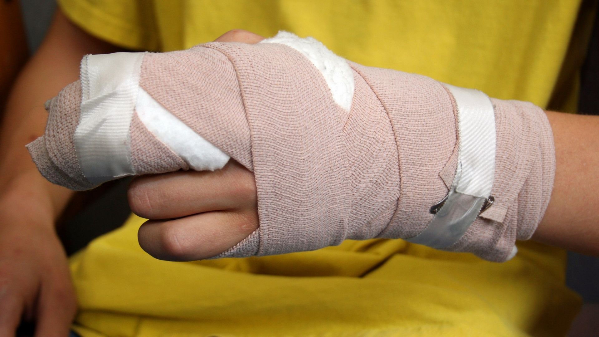 Hand Injury